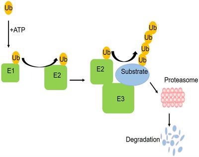 BK Channel Dysfunction in Diabetic Coronary Artery: Role of the E3 Ubiquitin Ligases